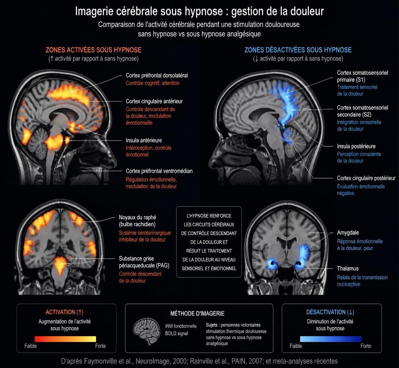 découvrez comment l'hypnose peut aider à gérer les douleurs chroniques, ses bénéfices réels et ce à quoi s'attendre grâce à cette approche thérapeutique.